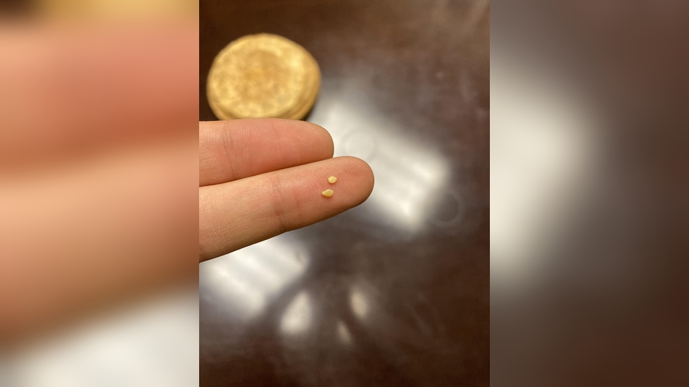 Are Bed Bug Eggs Hard