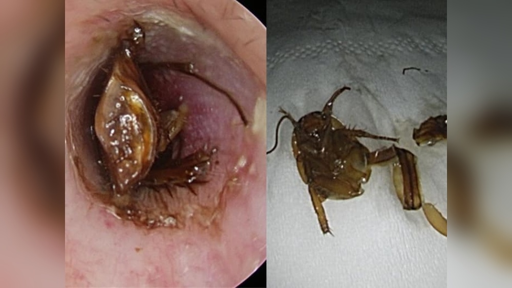 Can Cockroaches Crawl in Your Ear