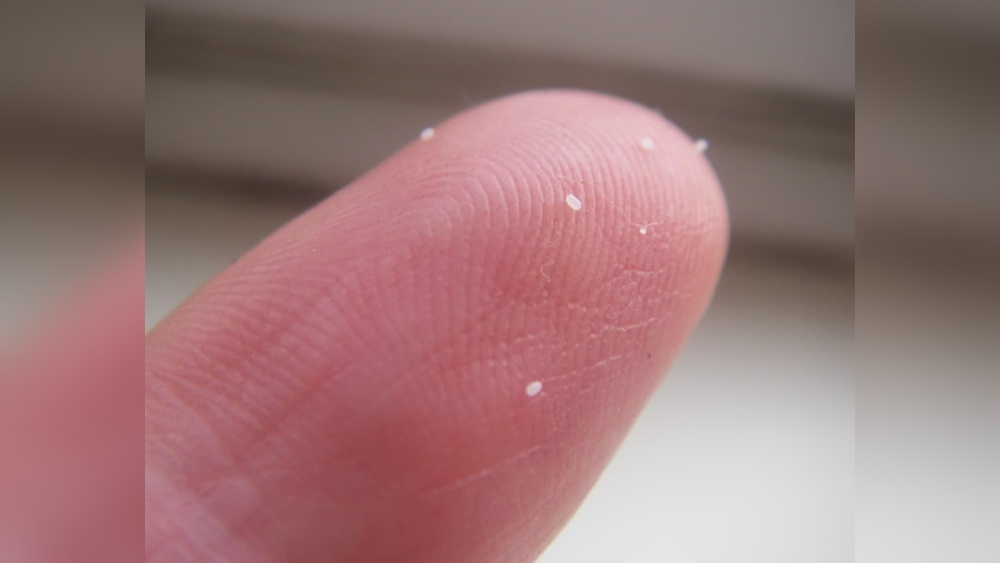 Can You See Flea Eggs