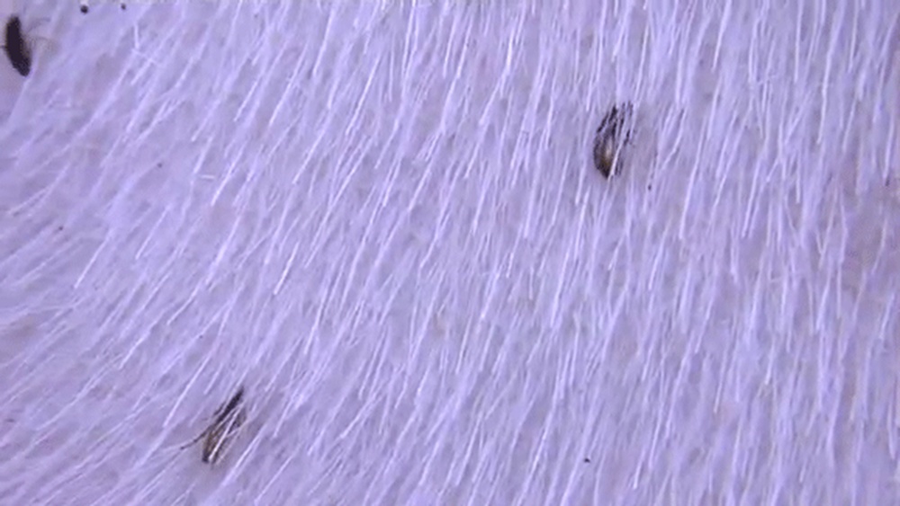 Do Fleas Jump Or Fly