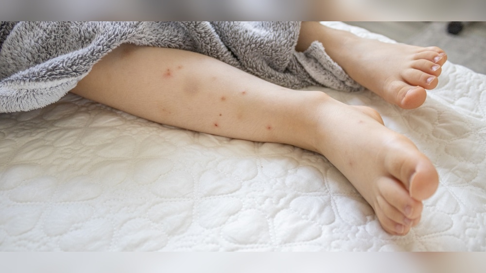 How to Get Rid of Fleas in Bed