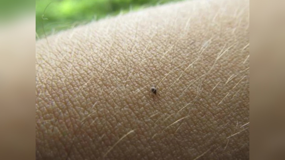 How to Get Rid of Seed Ticks on Dogs